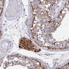 Immunohistochemical staining of human testis shows strong granular cytoplasmic positivity in Leydig cells.