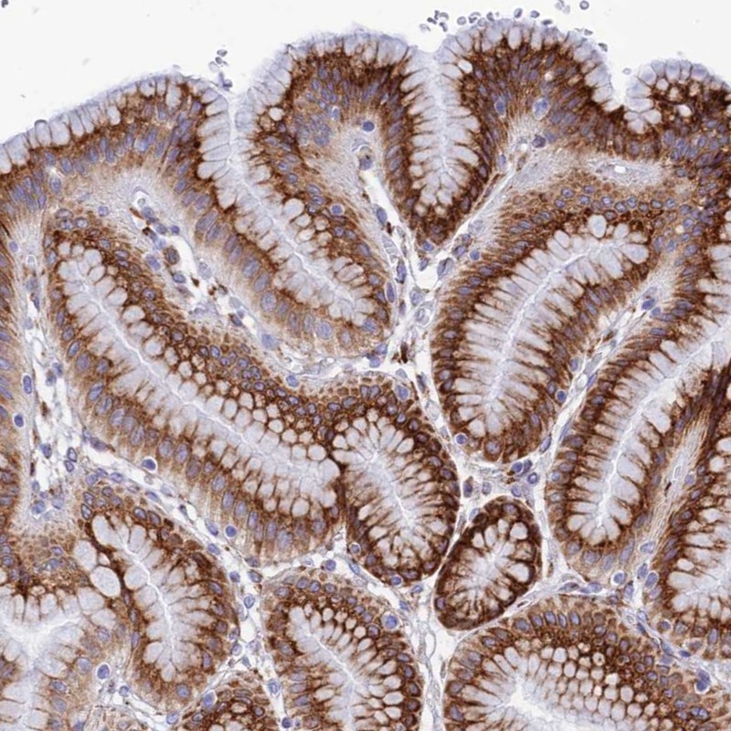 Anti-TUBGCP6 Antibody
