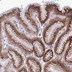 Anti-TUBGCP6 Antibody