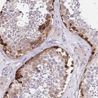 Anti-HERC5 Antibody