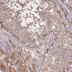 Anti-PTPMT1 Antibody