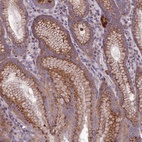 Anti-SPRYD7 Antibody