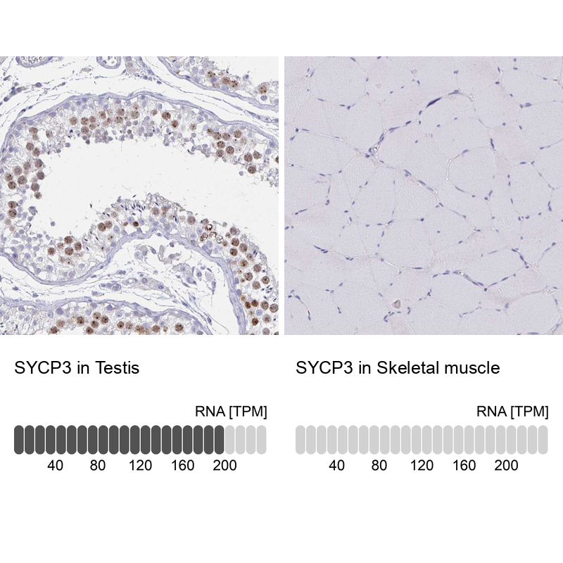 Anti-SYCP3 Antibody