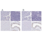 Immunohistochemical staining of human gastrointestinal, lymphoid tissues, skeletal muscle and testis using Anti-SYCP3 antibody HPA043938 (A) shows similar protein distribution across tissues to independent antibody HPA039635 (B).