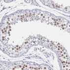 Immunohistochemical staining of human testis shows strong nuclear and nucleoli positivity in cells in seminiferous ducts.