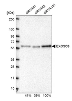 Western blot analysis in U2OS cells transfected with control siRNA, target specific siRNA probe #1 and #2, using Anti-EXOSC8 antibody. Remaining relative intensity is presented.