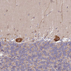 Immunohistochemical staining of human cerebellum shows strong cytoplasmic positivity in Purkinje cells.