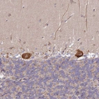 Immunohistochemical staining of human cerebellum shows strong cytoplasmic positivity in Purkinje cells.
