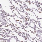 Immunohistochemical staining of human lung shows moderate cytoplasmic positivity in macrophages.
