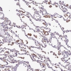 Immunohistochemical staining of human lung shows moderate cytoplasmic positivity in macrophages.