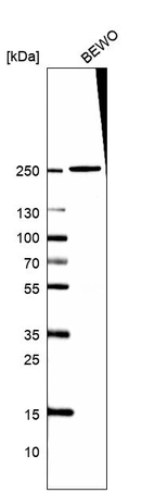 Western blot analysis in human cell line BEWO.