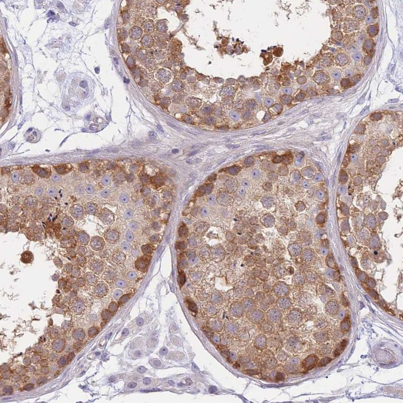 Anti-SUGT1 Antibody