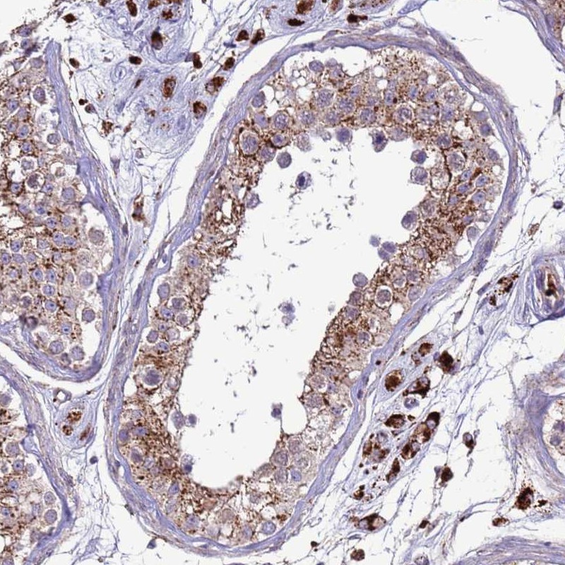 Anti-VPS36 Antibody