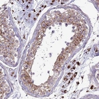 Anti-VPS36 Antibody