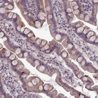 Immunohistochemical staining of human small intestines shows strong cytoplasmic positivity in glandular cells.