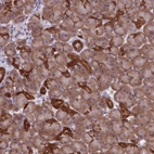 Immunohistochemical staining of human pancreas shows strong cytoplasmic positivity in exocrine glandular cells.
