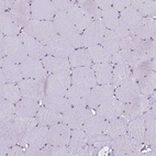 Immunohistochemical staining of human skeletal muscle shows no positivity in myocytes as expected.