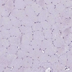 Immunohistochemical staining of human skeletal muscle shows no positivity in myocytes as expected.