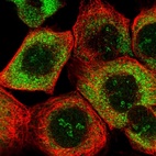 Immunofluorescent staining of human cell line A-431 shows localization to nucleoli, cytosol & endoplasmic reticulum.