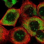 Immunofluorescent staining of human cell line A-431 shows localization to nucleoli, cytosol & endoplasmic reticulum.