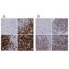 Immunohistochemical staining of human cerebral cortex, lymph node, spleen and tonsil using Anti-CD3E antibody HPA043955 (A) shows similar protein distribution across tissues to independent antibody HPA040957 (B).