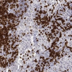 Immunohistochemical staining of human lymph node shows moderate to strong cytoplasmic positivity in lymphoid cells.