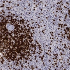 Immunohistochemical staining of human spleen shows moderate to strong cytoplasmic positivity in cells in red pulp.
