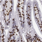 Immunohistochemical staining of human small intestine shows moderate to strong cytoplasmic positivity in lymphoid cells.