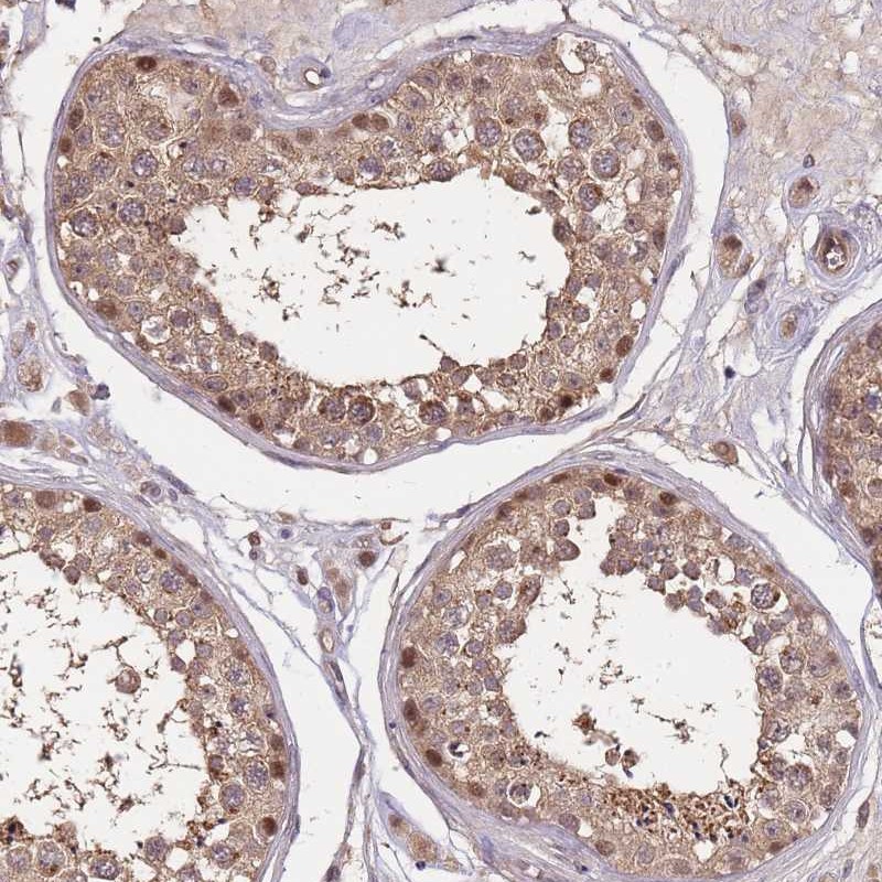 Anti-CDKN2AIPNL Antibody