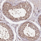 Anti-CDKN2AIPNL Antibody