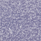 Immunohistochemical staining of human granular layer of the cerebellum shows no cytoplasmic positivity as expected.