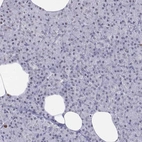 Immunohistochemical staining of human pancreas shows no cytoplasmic positivity in exocrine glandular cells as expected.