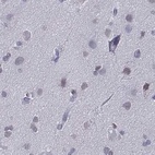 Anti-CD3E Antibody