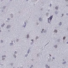 Immunohistochemical staining of human cerebral cortex using Anti-CD3E antibody HPA043955.