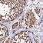 Anti-CCDC150 Antibody
