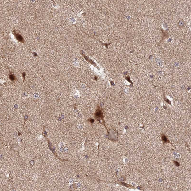 Anti-INO80D Antibody