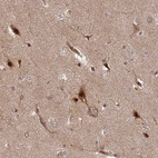 Anti-INO80D Antibody