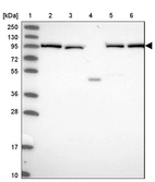Lane 1: Marker [kDa] 250, 130, 95, 72, 55, 36, 28, 17, 10_br/_Lane 2: Human cell line RT-4_br/_Lane 3: Human cell line U-251MG sp_br/_Lane 4: Human plasma (IgG/HSA depleted)_br/_Lane 5: Human liver tissue_br/_Lane 6: Human tonsil tissue