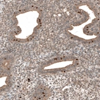 Immunohistochemical staining of human endometrium shows strong nuclear positivity in glandular cells.