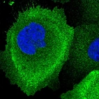 Immunofluorescent staining of human cell line A-431 shows localization to plasma membrane & cytosol.