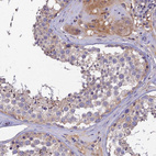 Immunohistochemical staining of human testis shows moderate cytoplasmic positivity in Leydig cells.