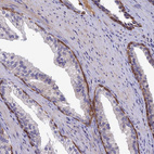 Immunohistochemical staining of human prostate shows strong cytoplasmic positivity in basal cells.