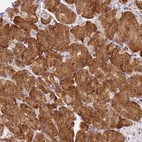 Anti-RHBDD3 Antibody