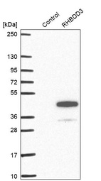 Anti-RHBDD3 Antibody