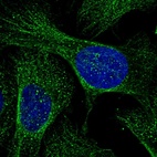 Anti-RHBDD3 Antibody