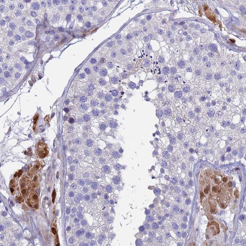 Anti-PPP6R1 Antibody