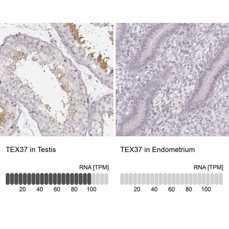Anti-TEX37 Antibody