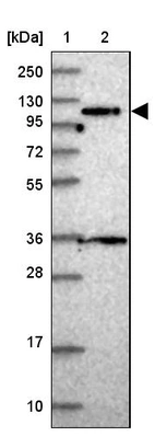Lane 1: Marker [kDa] 250, 130, 95, 72, 55, 36, 28, 17, 10_br/_Lane 2: Human cell line RT-4