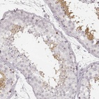 Immunohistochemical staining of human testis shows high expression.