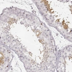 Immunohistochemical staining of human testis shows high expression.